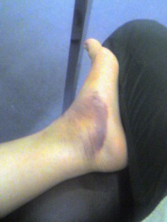 Ow :*( Ow :*(